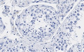 Anti-p14ARF Antibody, clone 4F19 ZooMAb® Rabbit Monoclonal recombinant, expressed in HEK 293 cells