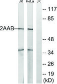 Anti-PPP2R1B antibody produced in rabbit affinity isolated antibody