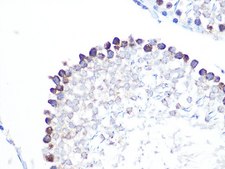 Anti-Stathmin 1 antibody produced in rabbit