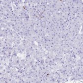 抗-CORO1A 兔抗 Prestige Antibodies® Powered by Atlas Antibodies, affinity isolated antibody, buffered aqueous glycerol solution