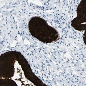 Anti-MUC5B antibody produced in rabbit Prestige Antibodies® Powered by Atlas Antibodies, affinity isolated antibody, buffered aqueous glycerol solution