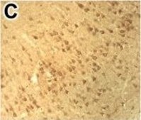 Anti-DNMT1 antibody produced in rabbit Prestige Antibodies® Powered by Atlas Antibodies, affinity isolated antibody, buffered aqueous glycerol solution