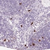 Anti-CMA1 antibody produced in rabbit Prestige Antibodies® Powered by Atlas Antibodies, affinity isolated antibody, buffered aqueous glycerol solution