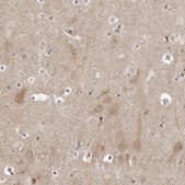 Anti-PTK2B antibody produced in rabbit Prestige Antibodies® Powered by Atlas Antibodies, affinity isolated antibody, buffered aqueous glycerol solution, ab2