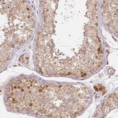Monoclonal Anti-RHOT1 antibody produced in mouse Prestige Antibodies® Powered by Atlas Antibodies, clone CL1083, purified immunoglobulin, buffered aqueous glycerol solution