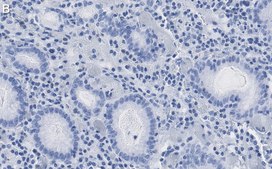 Anti-p-CREB (Ser133) Antibody, clone 1H13 ZooMAb® Rabbit Monoclonal recombinant, expressed in HEK 293 cells