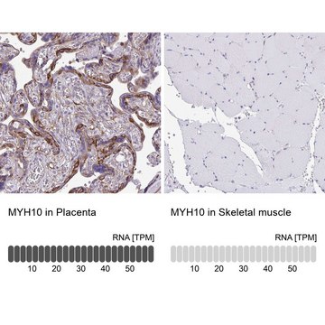 Anti-MYH10 antibody produced in rabbit Prestige Antibodies® Powered by Atlas Antibodies, affinity isolated antibody, buffered aqueous glycerol solution