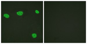 Anti-Vitamin D Receptor antibody produced in rabbit affinity isolated antibody