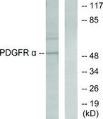 Anti-Peripherin antibody produced in rabbit affinity isolated antibody