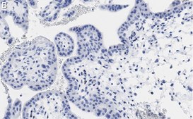 Anti-PDE4B Antibody, clone 1E9 ZooMAb® Rabbit Monoclonal recombinant, expressed in HEK 293 cells