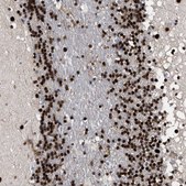 Anti-TP53BP1 antibody produced in rabbit Prestige Antibodies® Powered by Atlas Antibodies, affinity isolated antibody, buffered aqueous glycerol solution