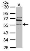 Anti-ALDH1A2 antibody produced in rabbit affinity isolated antibody, buffered aqueous solution