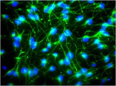Anti-Nestin Antibody, clone rat-401, Alexa Fluor™ 488 conjugate clone rat-401, from mouse, ALEXA FLUOR™ 488