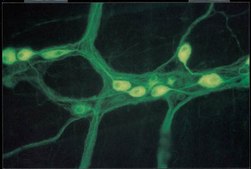 抗神经丝M（145 kDa）抗体，CT serum, Chemicon®