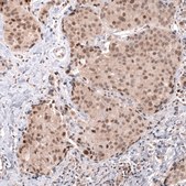 Monoclonal Anti-Msh3 Antibody Produced In Mouse Prestige Antibodies® Powered by Atlas Antibodies, clone CL14064, affinity isolated antibody, buffered aqueous glycerol solution
