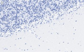 Anti-GluR-2 Antibody, clone 1K20 ZooMAb® Rabbit Monoclonal recombinant, expressed in HEK 293 cells