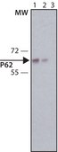 Anti-p62/SQSTM1 (C-terminal) antibody produced in rabbit affinity isolated antibody, buffered aqueous solution
