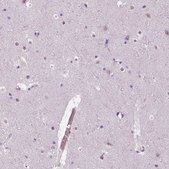 Anti-MKI67 antibody produced in rabbit Ab2, Prestige Antibodies® Powered by Atlas Antibodies, affinity isolated antibody, buffered aqueous glycerol solution