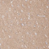 Anti-L1CAM antibody produced in rabbit Prestige Antibodies® Powered by Atlas Antibodies, affinity isolated antibody, buffered aqueous glycerol solution