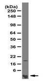 Anti-Amyloid, β 1-40, aβ Antibody from rabbit, purified by affinity chromatography
