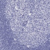 Anti-DNALI1 antibody produced in rabbit Prestige Antibodies® Powered by Atlas Antibodies, affinity isolated antibody, buffered aqueous glycerol solution
