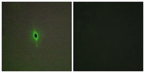 Anti-5-HT-2C antibody produced in rabbit affinity isolated antibody