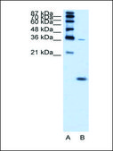Anti-HBZ antibody produced in rabbit IgG fraction of antiserum