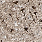 Anti-ZKSCAN1 antibody produced in rabbit Prestige Antibodies® Powered by Atlas Antibodies, affinity isolated antibody, buffered aqueous glycerol solution