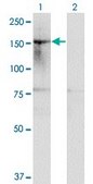 Monoclonal Anti-HDAC6 antibody produced in mouse clone 1E2, purified immunoglobulin, buffered aqueous solution