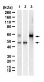 Anti-α1-Antitrypsin Antibody, clone 1K23 ZooMAb® Rabbit Monoclonal recombinant, expressed in HEK 293 cells