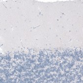 Anti-CFTR antibody produced in rabbit Prestige Antibodies® Powered by Atlas Antibodies, affinity isolated antibody, buffered aqueous glycerol solution