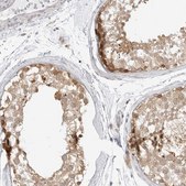 Anti-TCP1 antibody produced in rabbit Prestige Antibodies® Powered by Atlas Antibodies, affinity isolated antibody, buffered aqueous glycerol solution, ab1