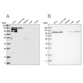 Anti-PTK2B antibody produced in rabbit Prestige Antibodies® Powered by Atlas Antibodies, affinity isolated antibody, buffered aqueous glycerol solution, ab1