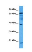 Anti-Klf2 antibody produced in rabbit affinity isolated antibody