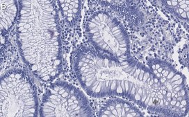 Anti-IL-17A Antibody, clone 1F21 ZooMAb® Rabbit Monoclonal recombinant, expressed in HEK 293 cells