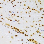 Anti-HMGB1 antibody produced in rabbit