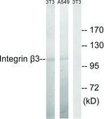Anti-Integrin β3 antibody produced in rabbit affinity isolated antibody