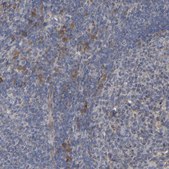 Anti-MOGS antibody produced in rabbit Prestige Antibodies® Powered by Atlas Antibodies, affinity isolated antibody, buffered aqueous glycerol solution