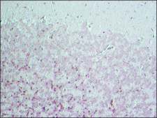 Anti-BACE 1, N-Terminus (46-62) antibody produced in rabbit affinity isolated antibody, buffered aqueous solution