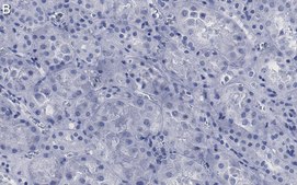 Anti-Ezrin Antibody, clone 1D15 ZooMAb® Rabbit Monoclonal recombinant, expressed in HEK 293 cells