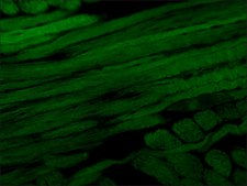 Anti-Myosin (Skeletal, Fast) antibody, Mouse monoclonal clone MY-32, purified from hybridoma cell culture