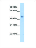 Anti-SerPINE1 (AB1) antibody produced in rabbit affinity isolated antibody