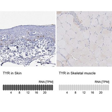 Anti-TYR antibody produced in rabbit Prestige Antibodies® Powered by Atlas Antibodies, affinity isolated antibody, buffered aqueous glycerol solution
