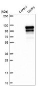 Anti-MMP9 antibody produced in rabbit Prestige Antibodies® Powered by Atlas Antibodies, affinity isolated antibody, buffered aqueous glycerol solution
