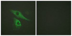 Anti-Keratin 8 antibody produced in rabbit affinity isolated antibody
