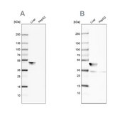 Anti-BHMT antibody produced in rabbit Prestige Antibodies® Powered by Atlas Antibodies, affinity isolated antibody, buffered aqueous glycerol solution