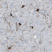 抗 MAP2 兔抗 affinity isolated antibody, buffered aqueous glycerol solution