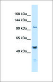 Anti-KCNMA1 antibody produced in rabbit affinity isolated antibody