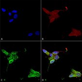 单克隆抗-TRPM7 小鼠抗 clone S74-25, 1 mg/mL, purified immunoglobulin