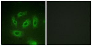 抗-TGF β 受体I 兔抗 affinity isolated antibody